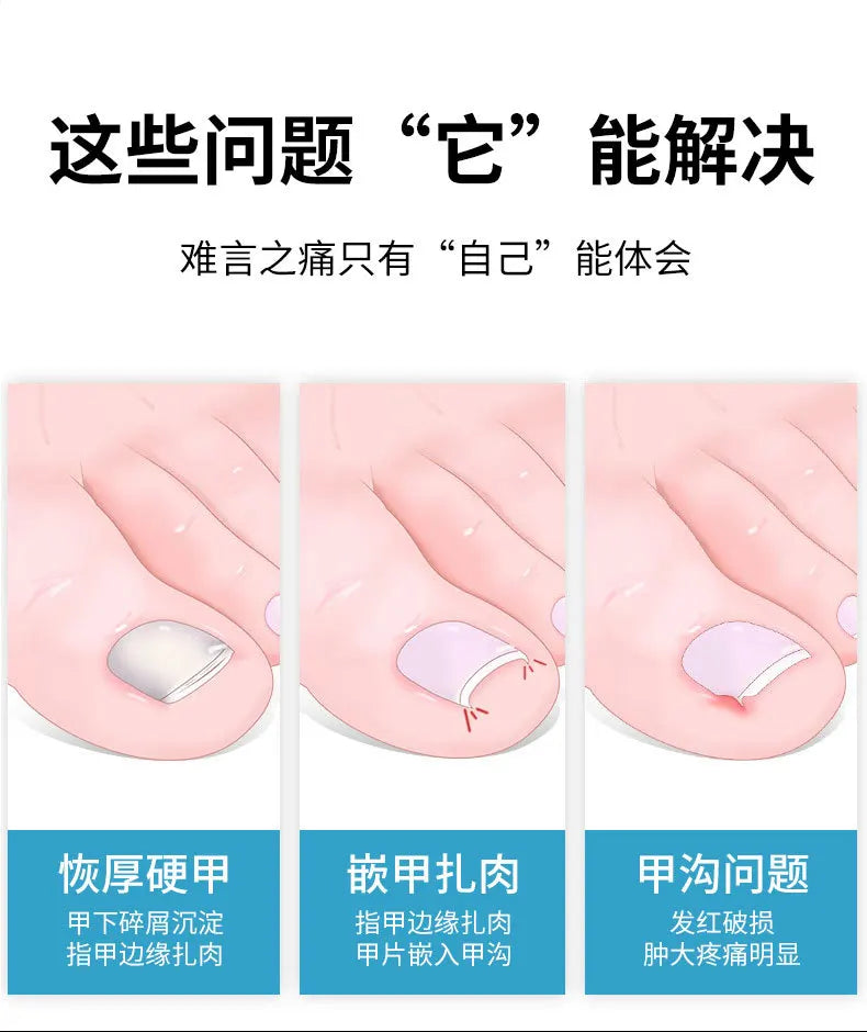 Nail Clipper Set Convenient Beauty Tools Ingrown ToeNail Scissors Dead Skin Manicure Nail Trimmer Pedicure Knife Manicure Tool