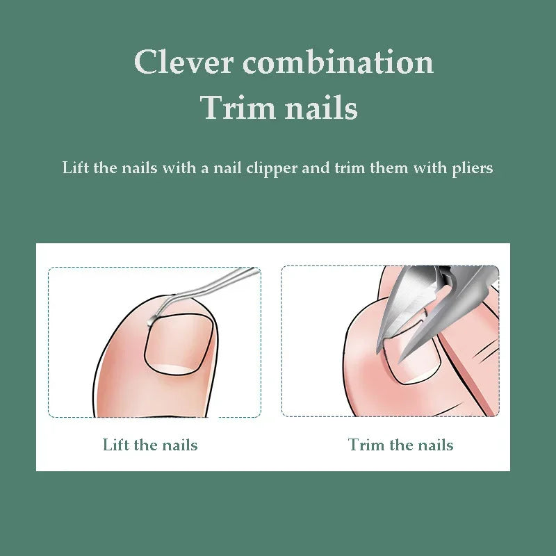 Nail Clipper Set Convenient Beauty Tools Ingrown ToeNail Scissors Dead Skin Manicure Nail Trimmer Pedicure Knife Manicure Tool